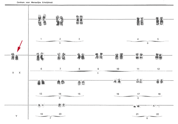 chromosoomkaart