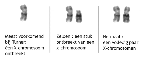 X-chromosomen